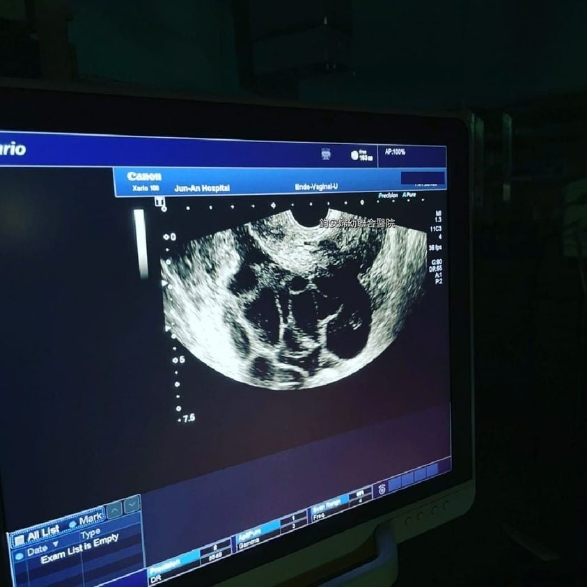 鈞安婦幼聯合醫院的試管嬰兒中心圖片